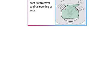 How to Use a Dental Dam